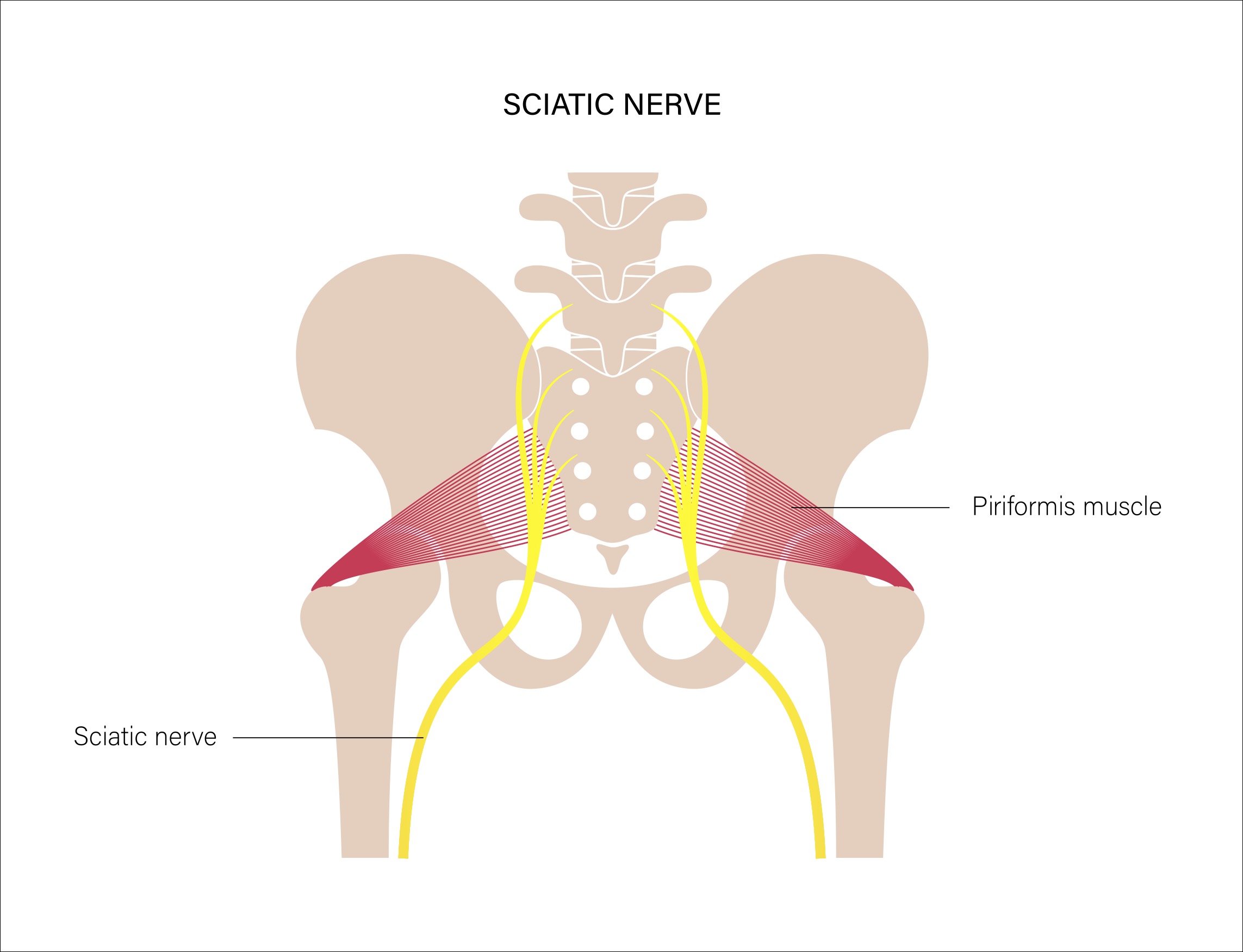 low back pain