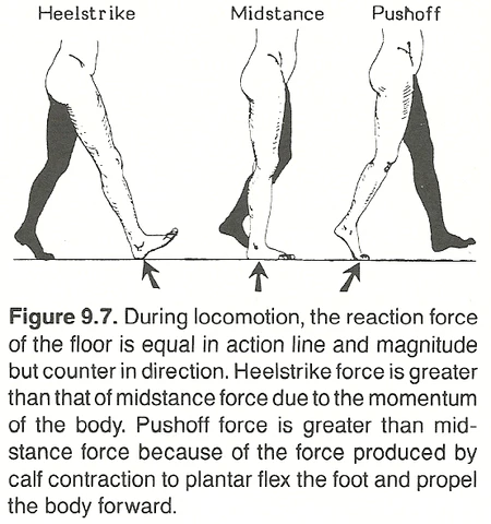 low back pain