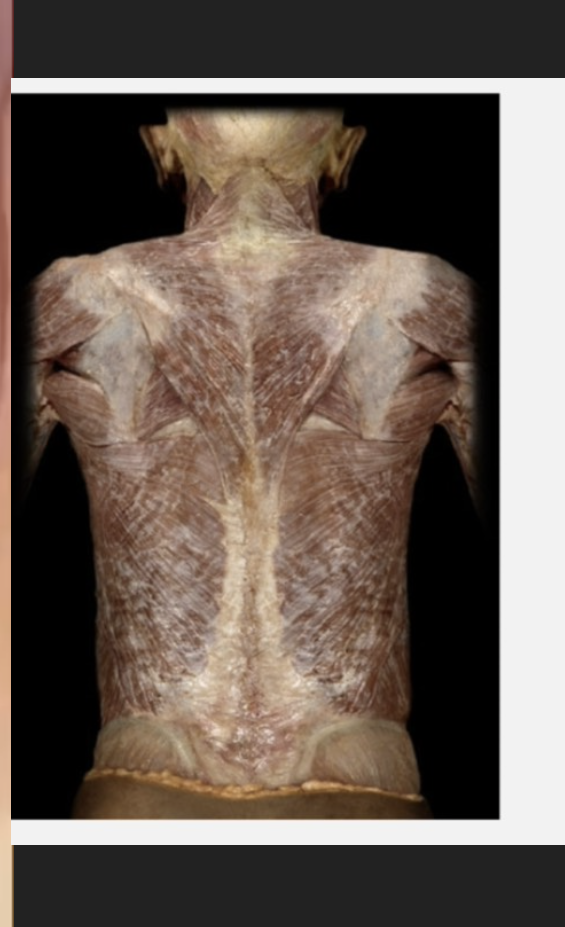 posterior oblique sling