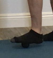 plantar fasciitis